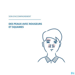 Ducray KELUAL DS Crème apaisante visage anti-squames -Peaux irritées avec rougeurs et squames