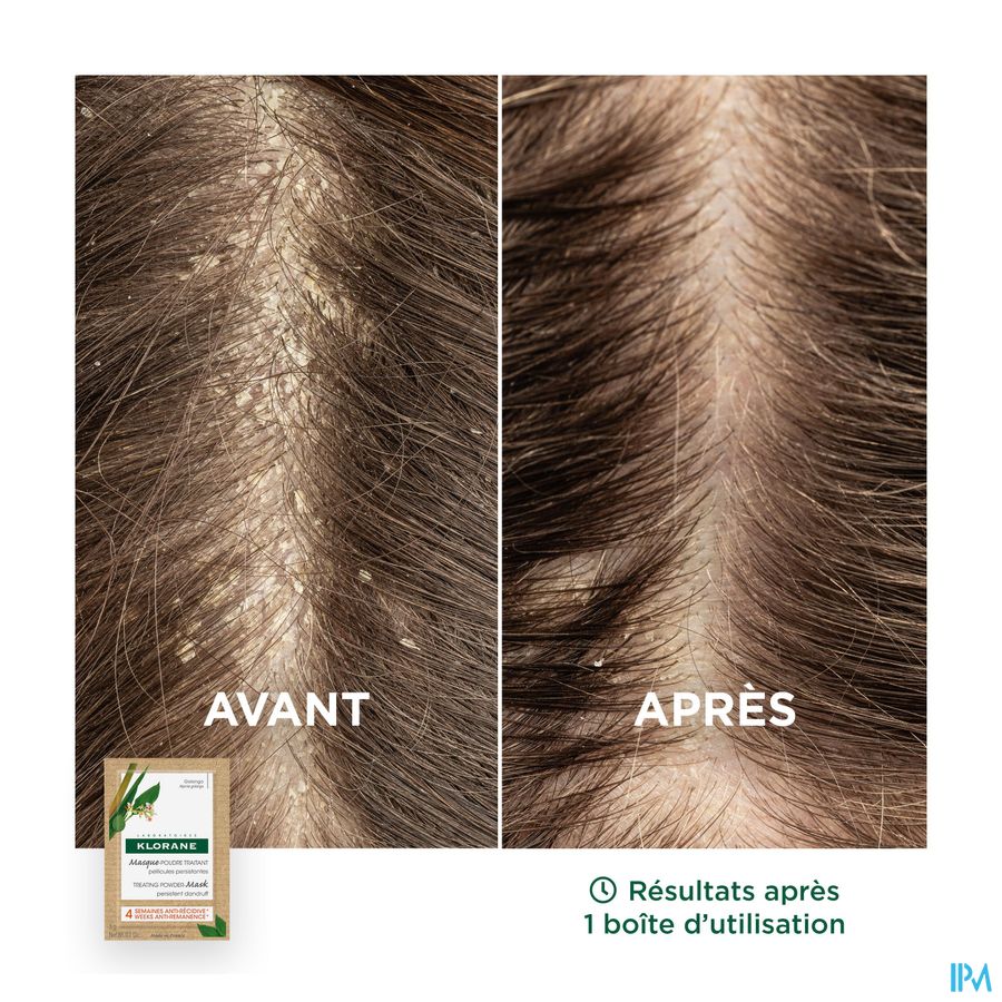 Klorane — Masque-Poudre Traitant Antipelliculaire au Galanga – Pellicules persistantes