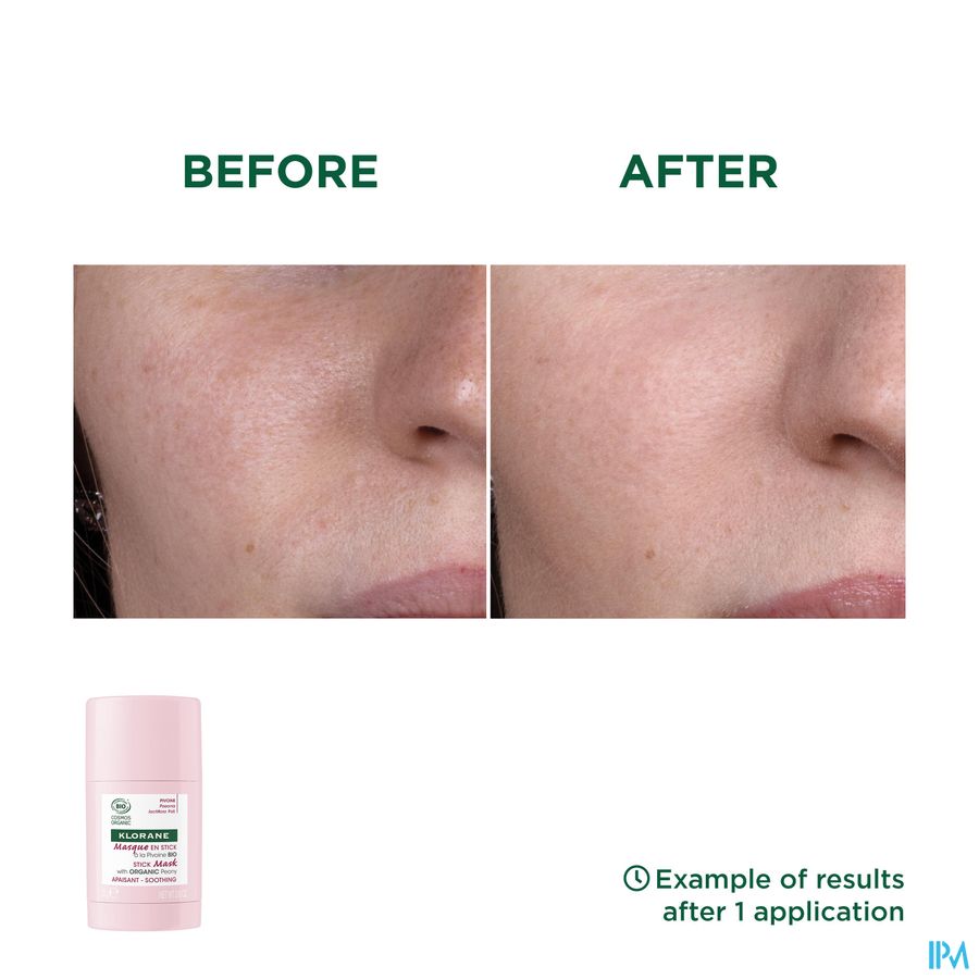 Klorane — Masque en Stick Apaisant à la Pivoine BIO — Peaux sensibles