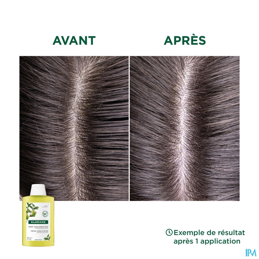 Klorane - Shampoing Légèreté à la pulpe de Cédrat - Cheveux normaux regraissant vite - Assainissant