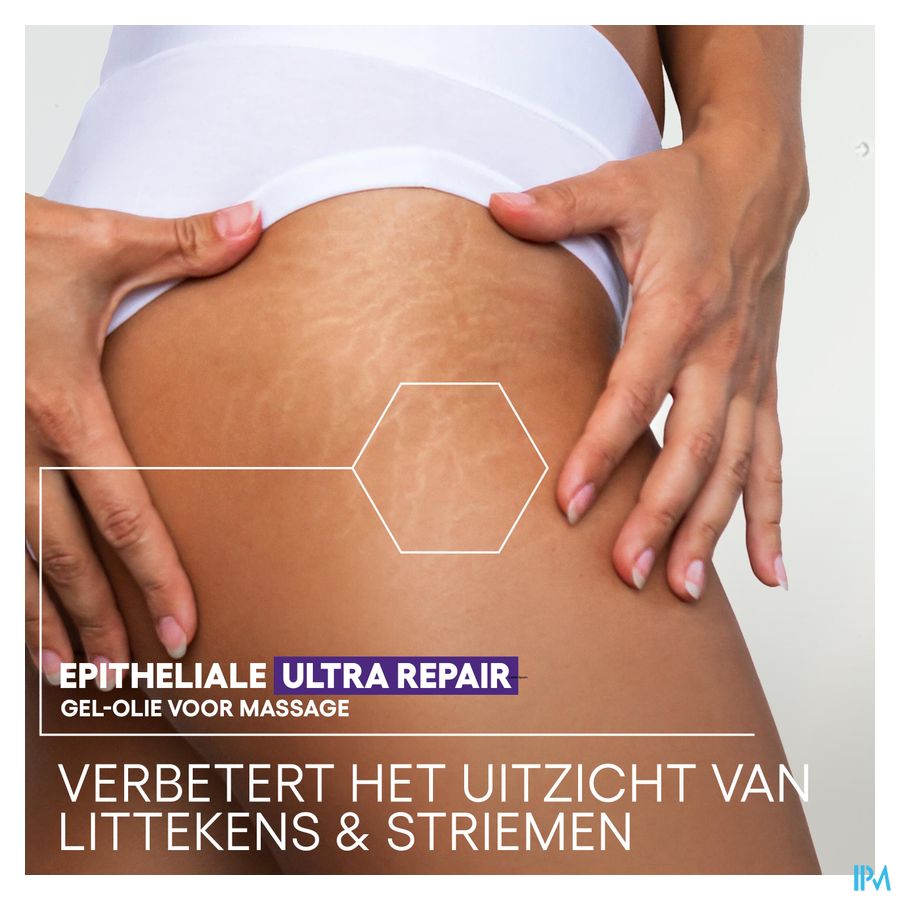 A-DERMA Epitheliale ULTRA REPAIR Gel-huile de massage anti-marques, Cicatrices et vergetures 100ml