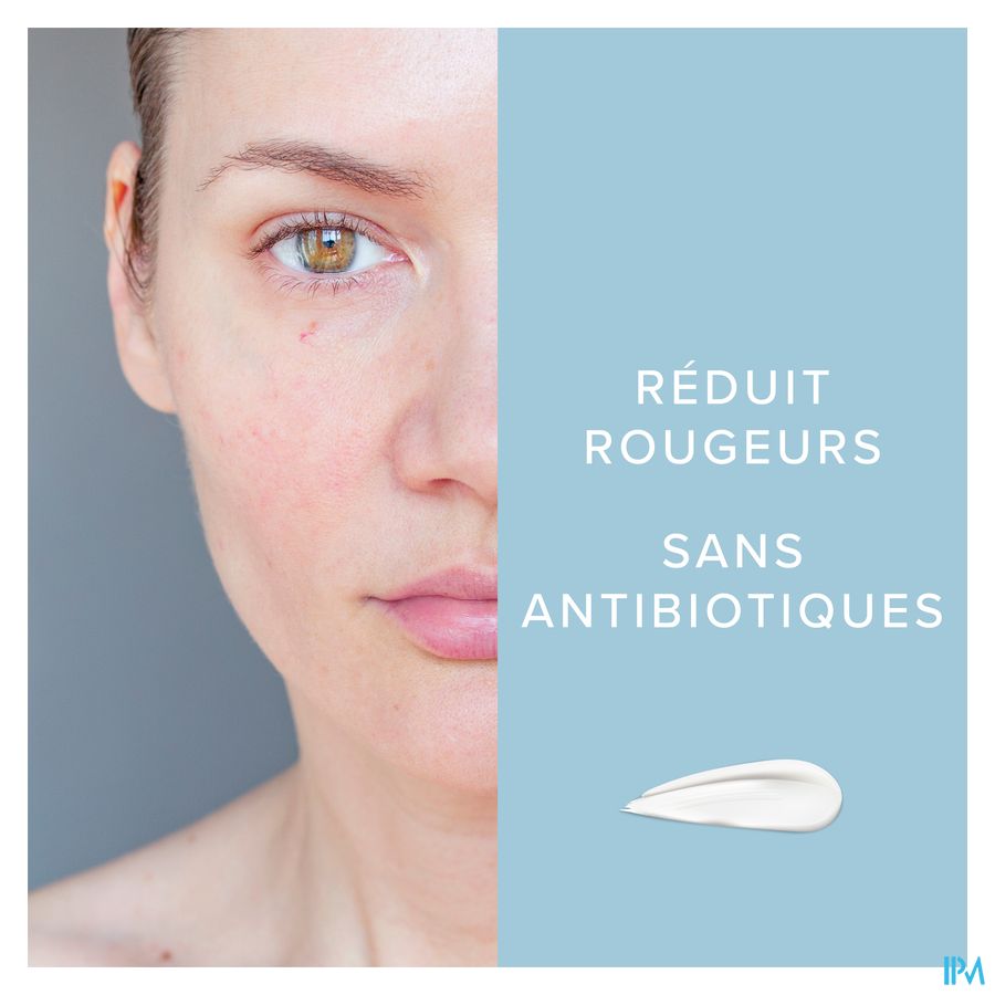 Dermalex® Anti-Rougeurs - Rosacee - Sans Cortisone - 30 ml