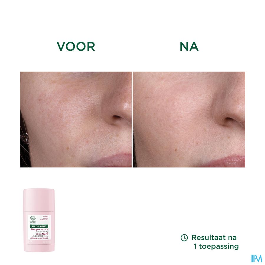 Klorane — Masque en Stick Apaisant à la Pivoine BIO — Peaux sensibles
