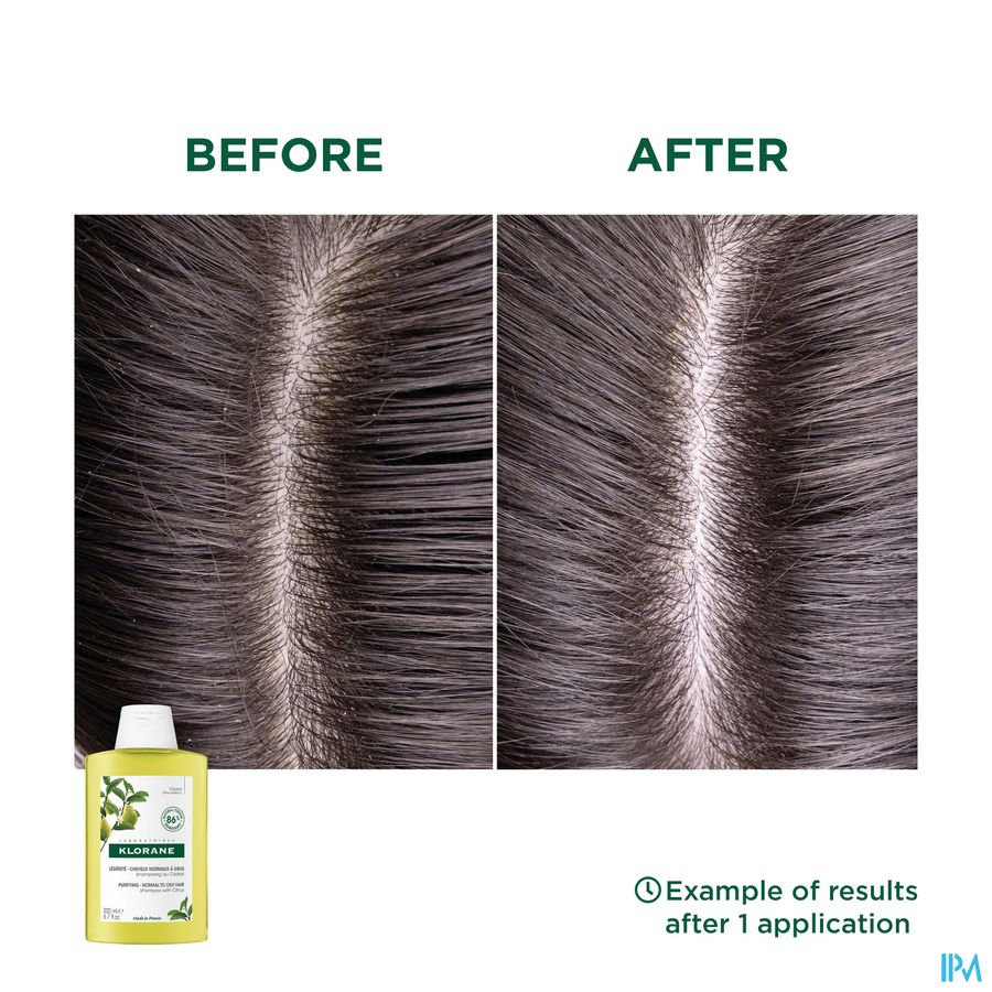 Klorane - Shampoing Légèreté à la pulpe de Cédrat - Cheveux normaux regraissant vite - Assainissant