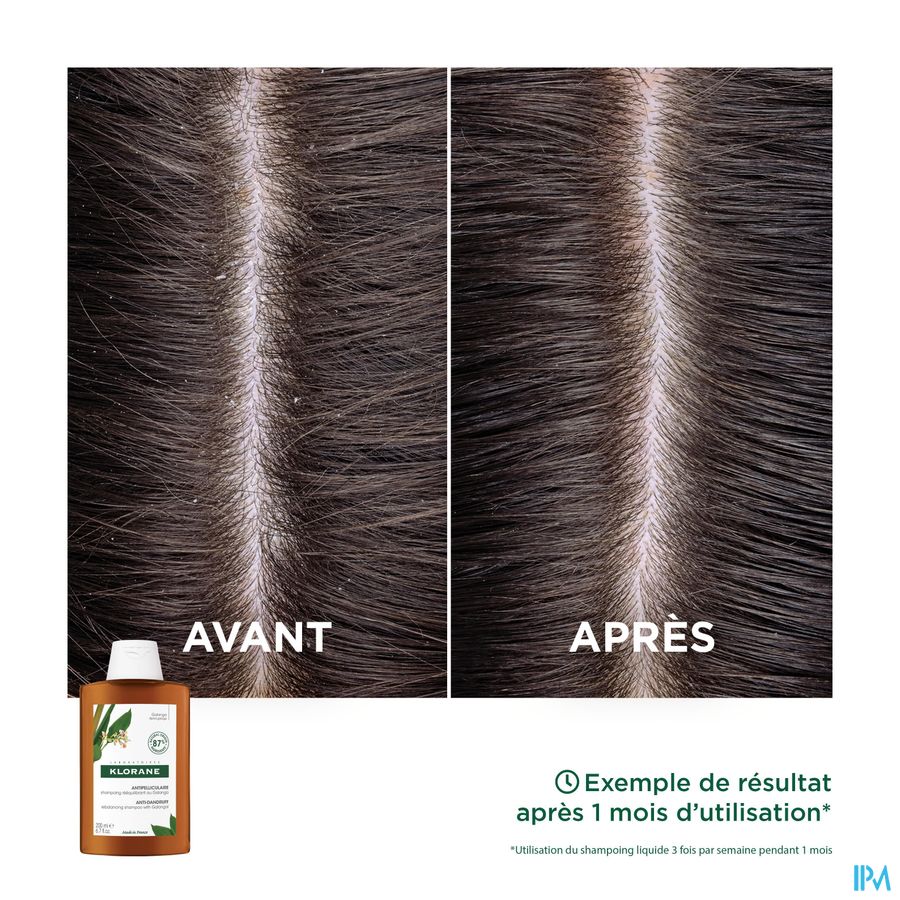 Klorane — Shampoing Rééquilibrant Antipelliculaire au Galanga — Pellicules libres