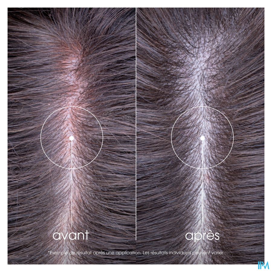 APAISANT Shampoing anti-irritation et protecteur