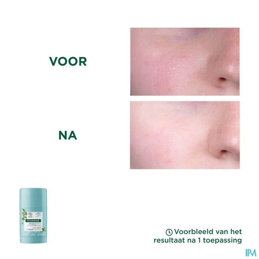Klorane - Masque en stick Purifiant à la Menthe BIO et argile soin anti-imperfections peaux grasses à tendance acnéique