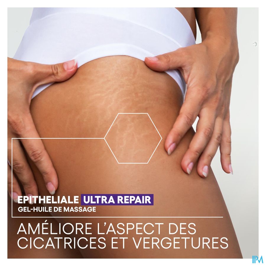 A-DERMA Epitheliale ULTRA REPAIR Gel-huile de massage anti-marques, Cicatrices et vergetures 100ml