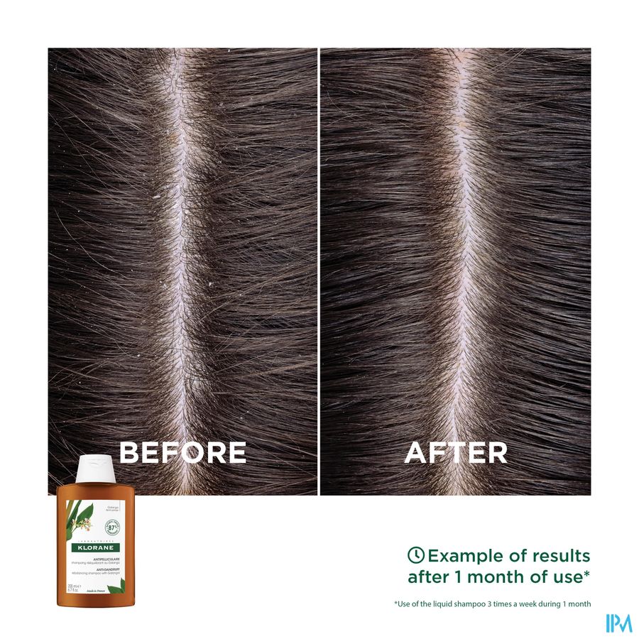 Klorane — Shampoing Rééquilibrant Antipelliculaire au Galanga — Pellicules libres