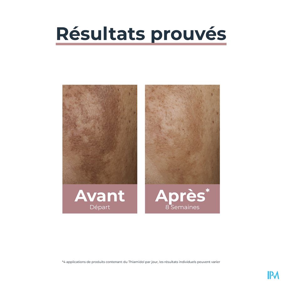 Anti-Pigment Correcteur de Taches Application Locale Hyperpigmentation 5ml