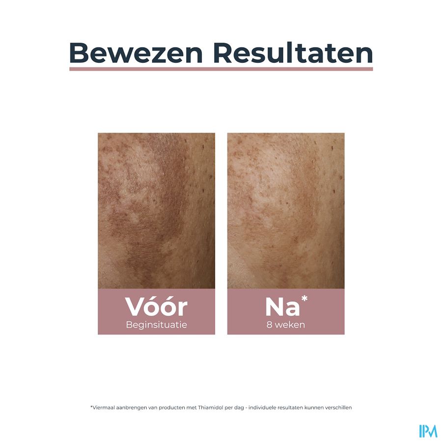 Anti-Pigment Correcteur de Taches Application Locale Hyperpigmentation 5ml